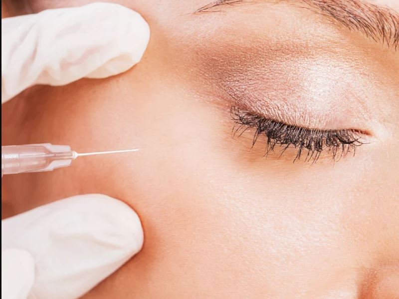 Patient smiling naturally after subtle Botox treatment